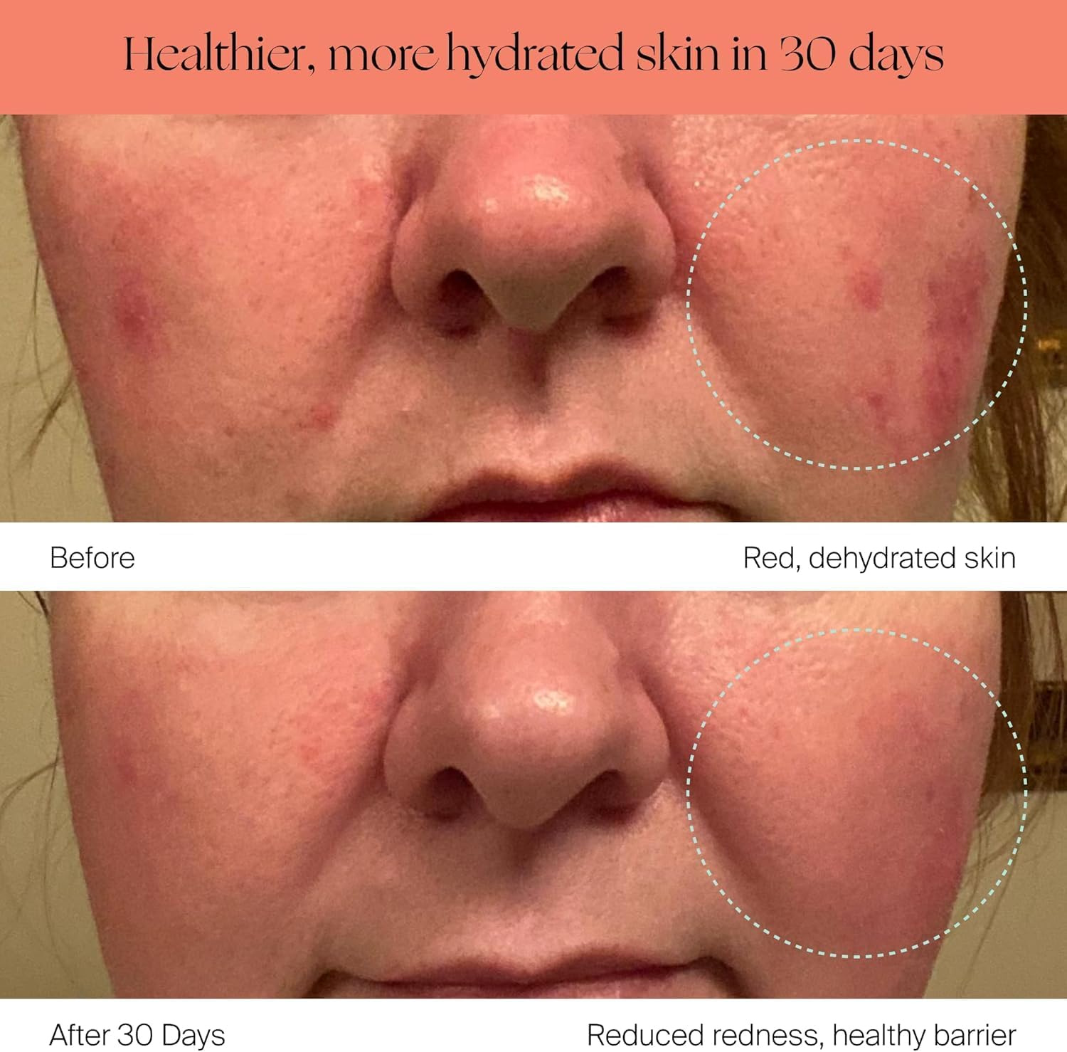 Canopy Large Room Humidifier, Cream, Large Living Space, 36HR Run Time, 5.5L Tank - Includes Canopy Humidifier Plus, Diffusion Well, Unwind Aroma, Filter, Power Cord & Adapter