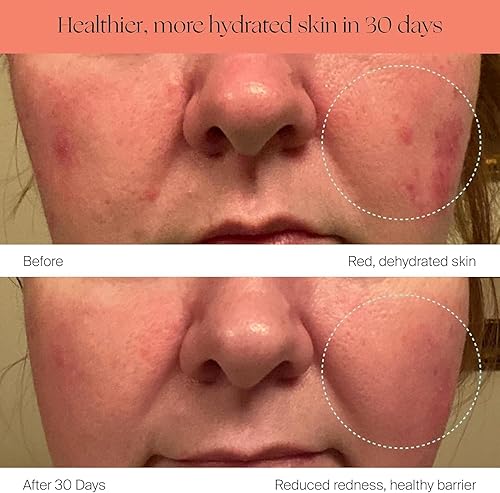 Miniatura 6 de Canopy Humidificador de habitación grande, Moonstruck, gran espacio vital, tiempo de funcionamiento de 36 horas, tanque de 5.5 litros, incluye