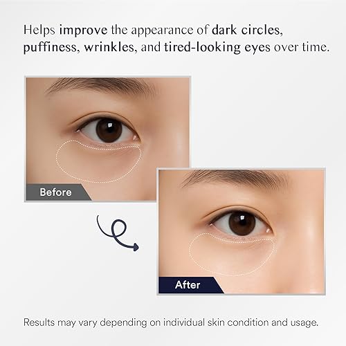 Miniatura 3 de Parches debajo de los ojos para hinchazón y bolsas máscara de ojos para ojos hinchados y ojeras tratamiento con retinol de colágeno - Almohadillas