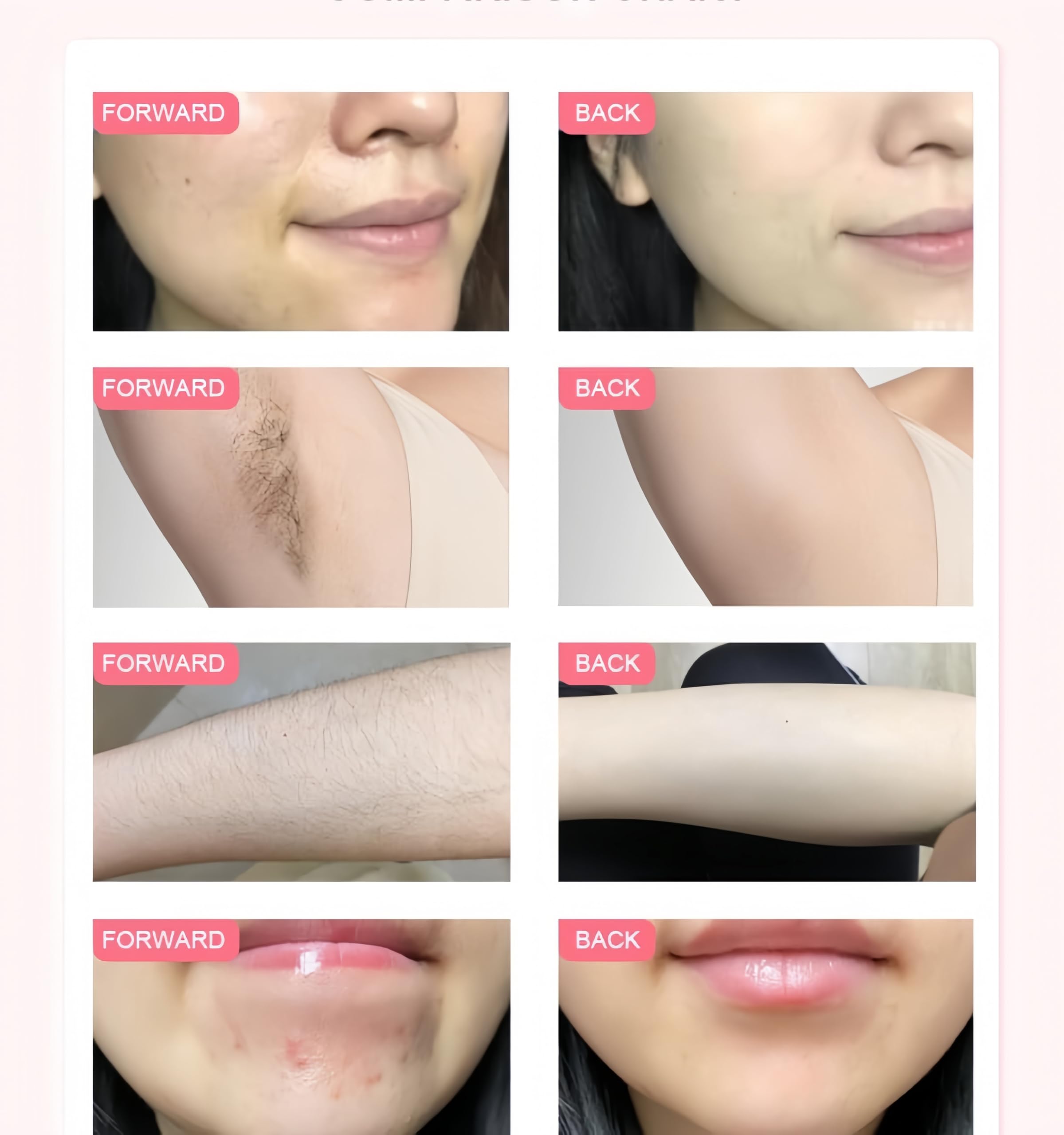 Professional 808nm diodo laser depilatore rapido depilazione permanente 4 lunghezze d'onda del viso depilazione del corpo
