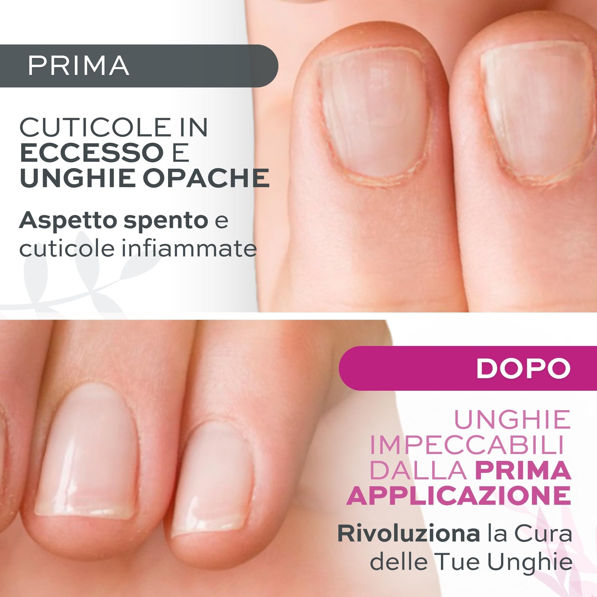 Rimuovi Cuticole Professionale 12 ml – Ammorbidisce e Rimuove Pellicine in 2-5 Minuti – Cuticle Remover Delicato e Profumato – Ideale per Manicure e Pedicure – Risultato Preciso e Unghie Curate