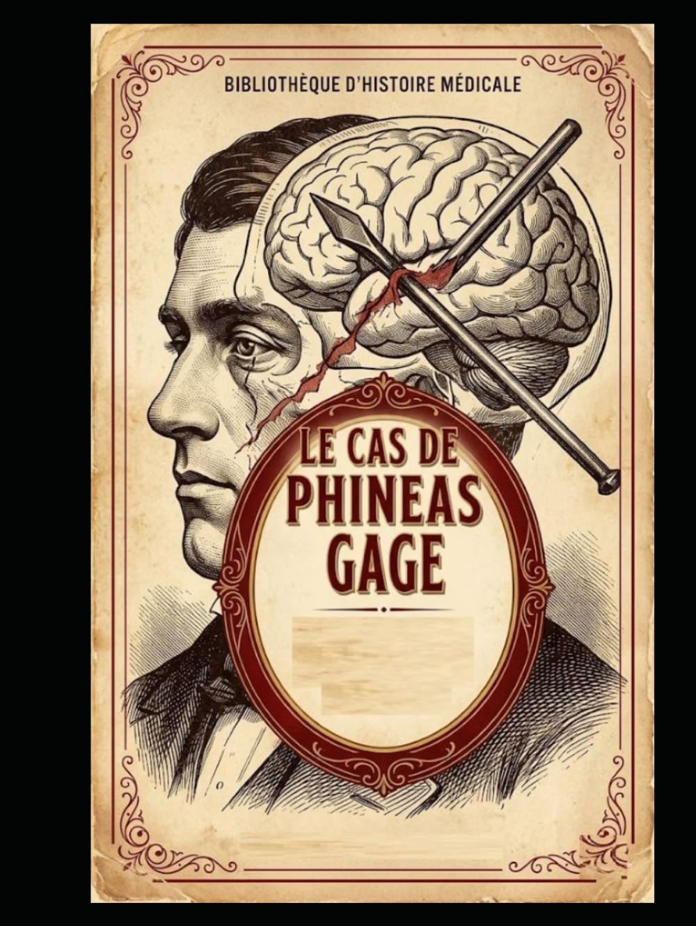 Le Cas de Phineas Gage : Entre l’Esprit et le Cerveau