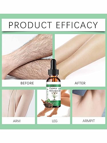 Miniatura 6 de Aceite Cyperus Rotundus, nuevo aceite Cyperus Rotundus para depilación, 2.0 fl oz de aceite de ciprés natural para todo tipo de piel (2)