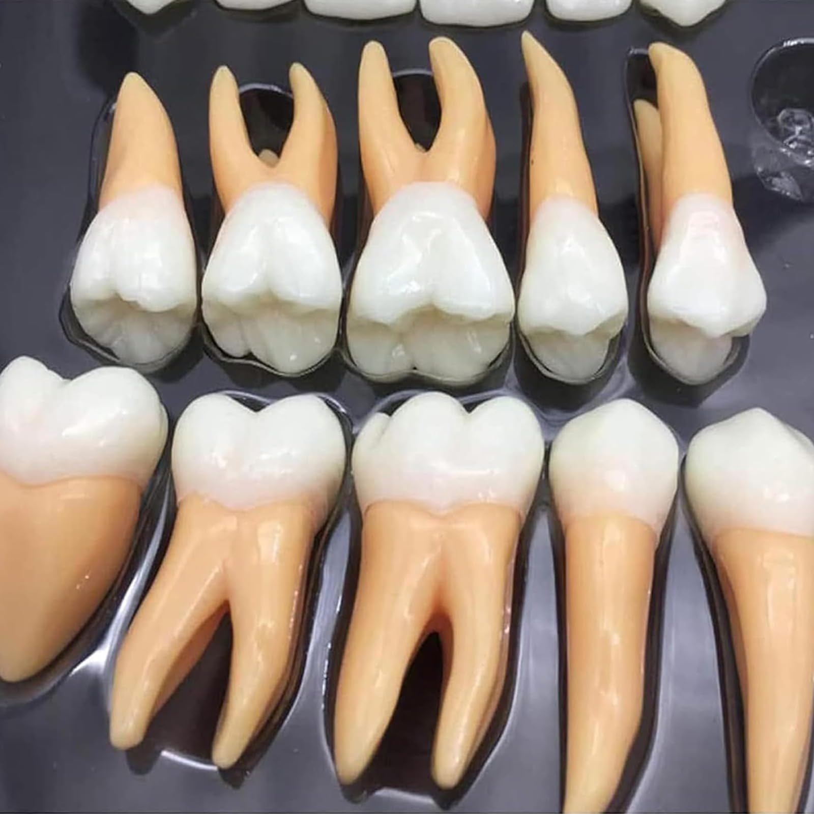 Kit di denti dentali ingranditi con custodia, strumento didattico educativo per professionisti dentali e studenti