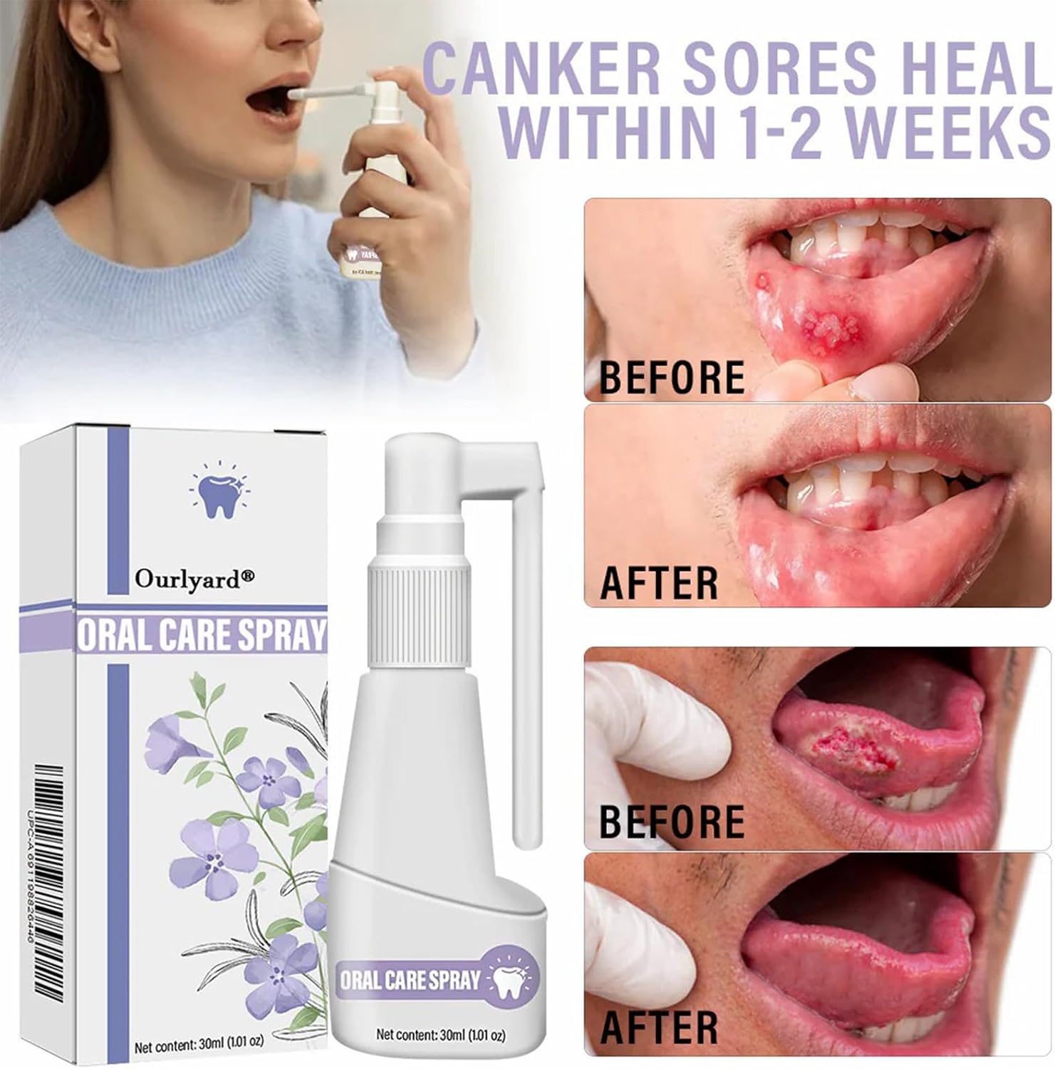 Clove Oil Oral Care Spray,Clove mouthwash,Clove Oil for Teeth and Gums (3PCS) image 2