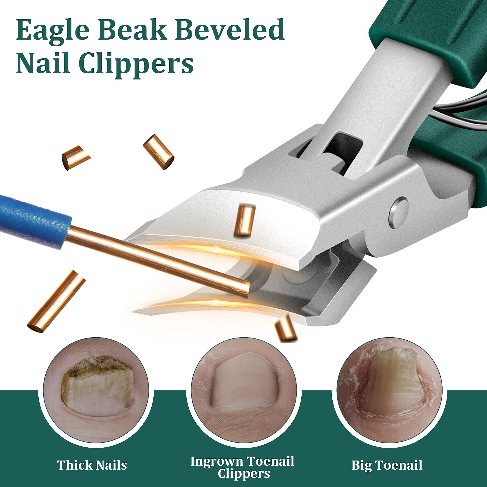 Eagle Beak Nail Clippers - Ingrown Toenails -2