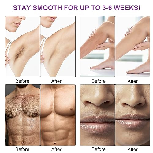 Miniatura 4 de NYANDU - Kit de depilación para mujeres y hombres calentador de cera para depilación cuentas de cera de 176 onzas 5 paquetes kit de cera dura para