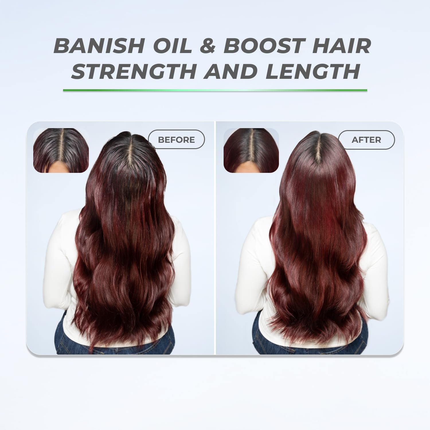 XMONDO Hair BOOST X Dry Shampoo, Zero Residue, Formulated with Saw Palmetto to Promote Scalp Care, Clinically Tested, Dermatologist Tested, Talc-free, Benzene-free, Free of aluminum starch, 5 oz