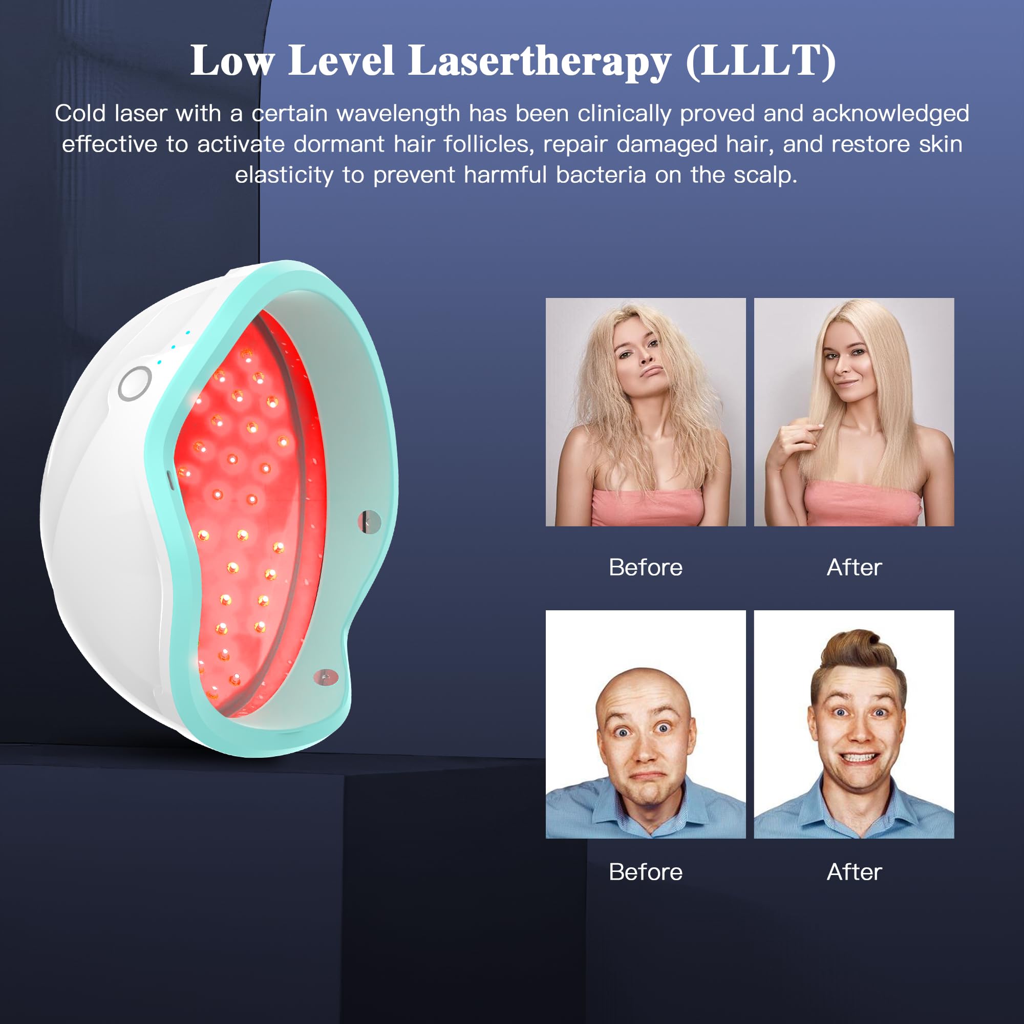 Kabellose Rotlichttherapie Kappe für Haarwuchs, Laser-Haarwuchshelm und Hut ohne Kabel, Haarausfallbehandlung bei dünner werdendem Haar, Geheimratsecken und Haarausfall nach der Geburt