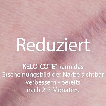 Kelo-cote silicone gel for treating scars 15 g