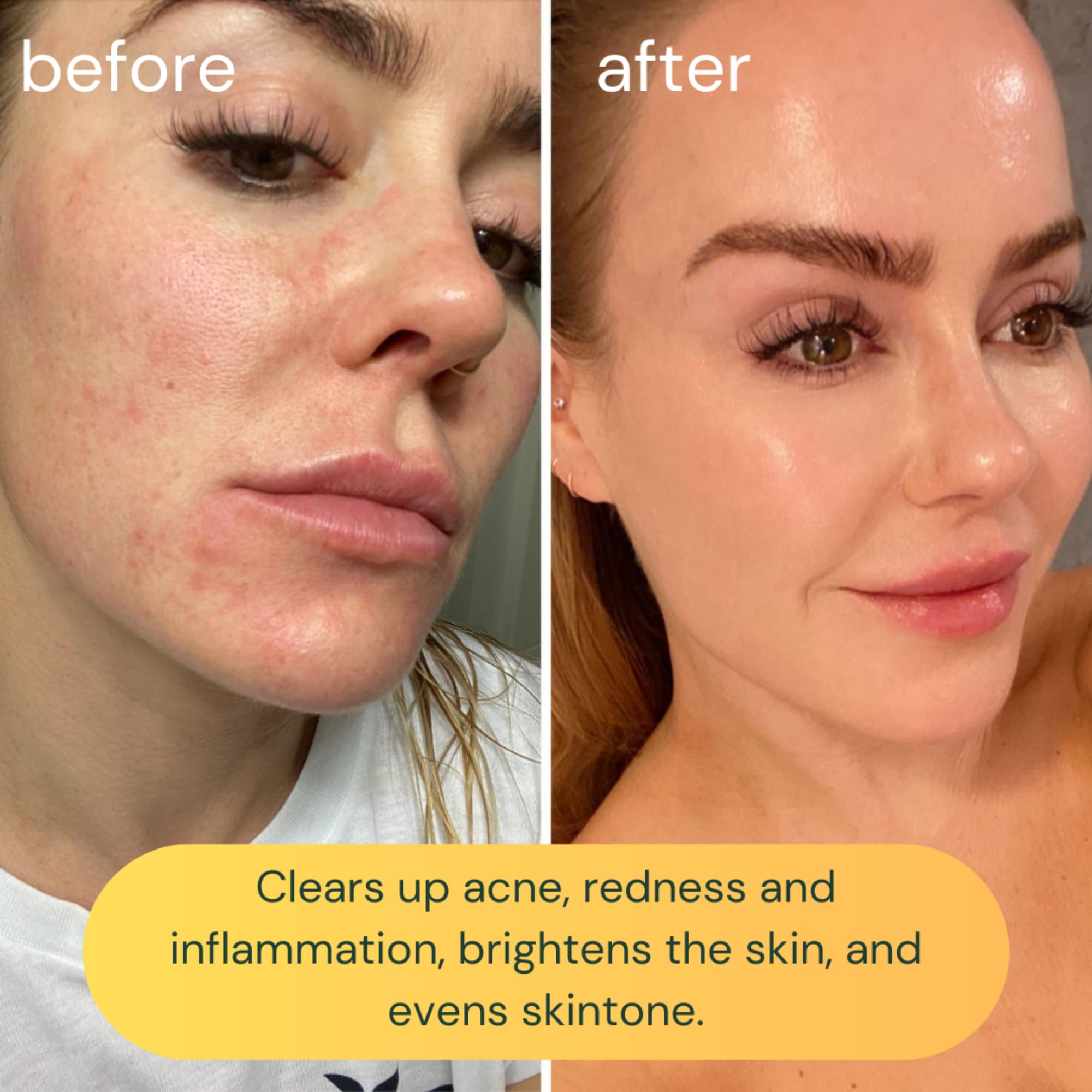koa life vitamin c lip Treatment 0.35 oz Seller assumes all responsibility for this listing KOA LIFE Lip Treatment Infused