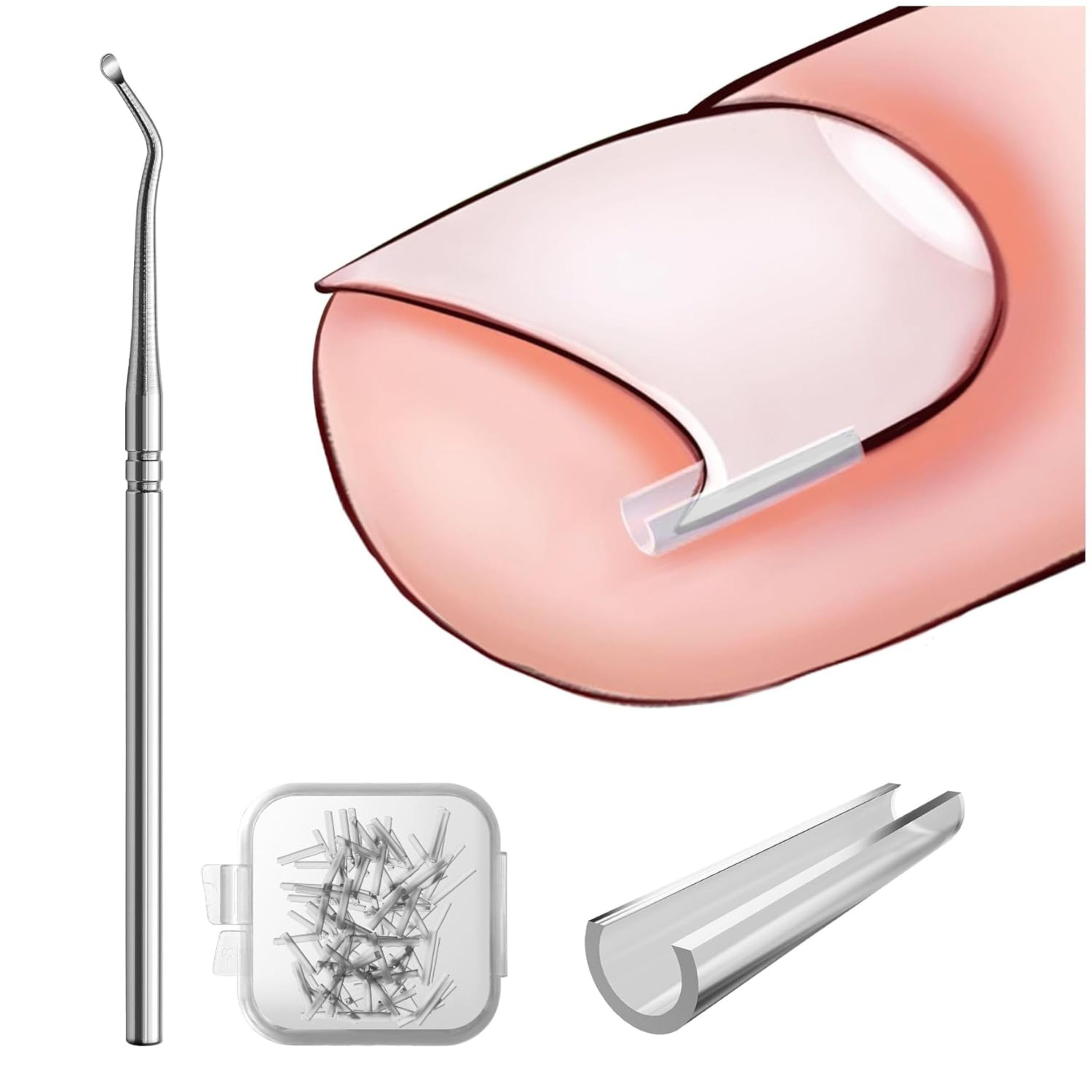 THYNOX Ingrown Toenail Corrector Kit with 20 Corrector Strips & Ingrown Toenail Correction Tool | Toe Nail Corrector & Ingrown Toe Nail Remover for Safe Nail Care and Post-Exercise Maintenance