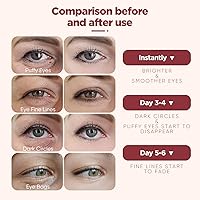 Vista 5 de Under Eye Patches (20 Pairs), 24K Gold Eye Mask & Hyaluronic Acid Eye Patches For Puffy Eyes, Dark Circles, Puffiness, Refresh,Revitalizing