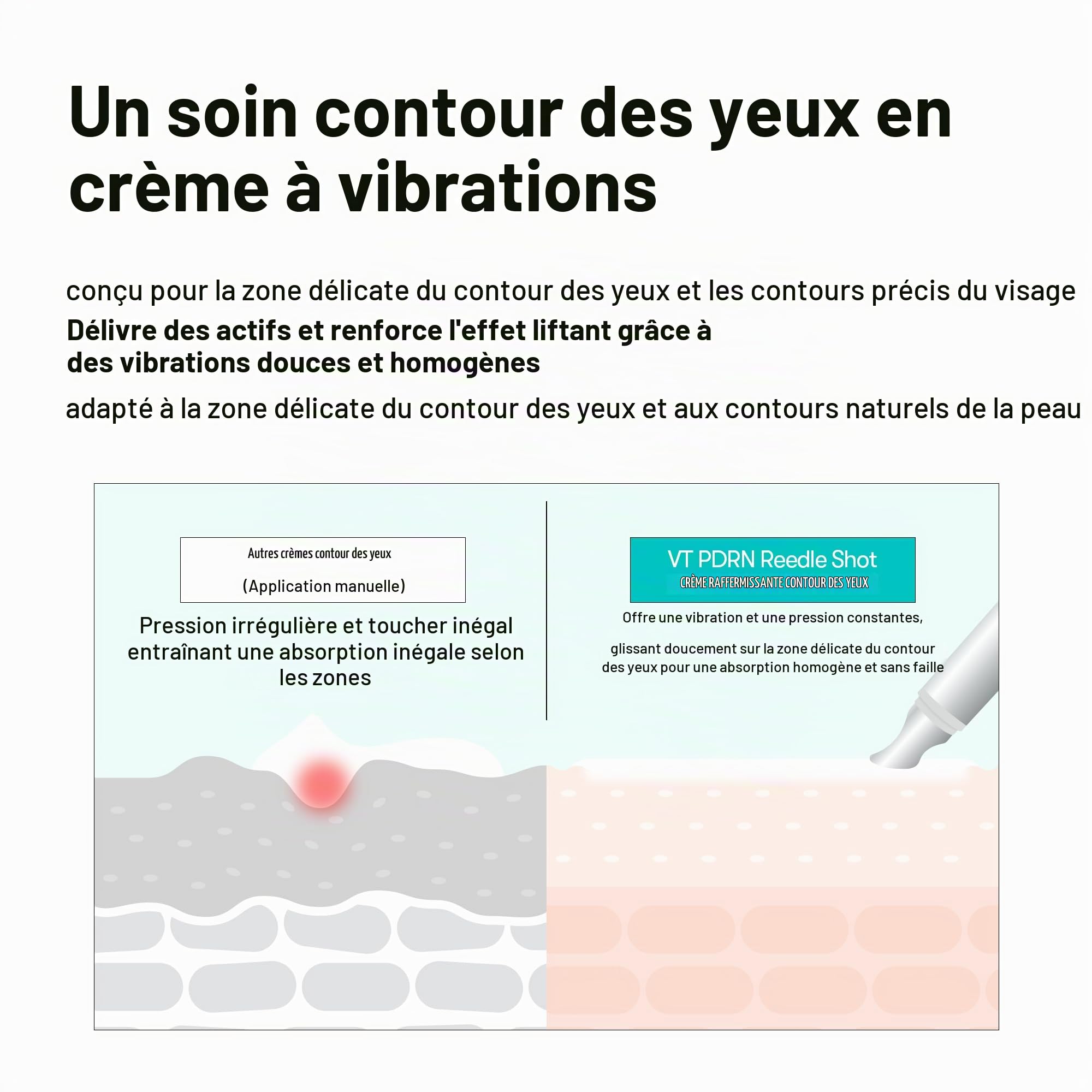 Vue 6