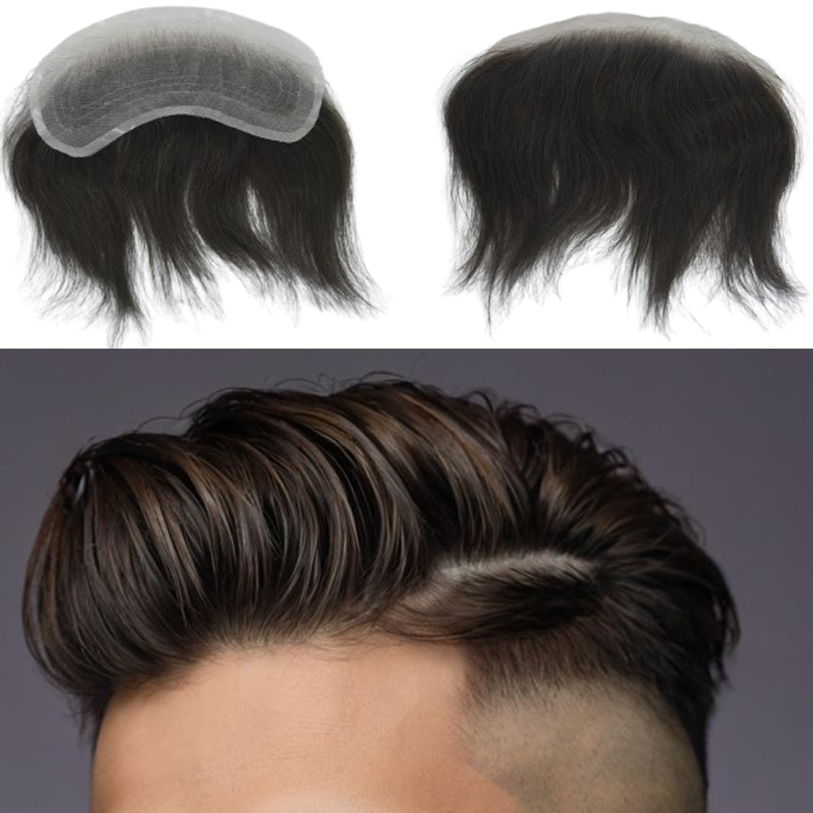 Hairline Realness Receding Hairline: Stages, Causes, and Treatments main image 2