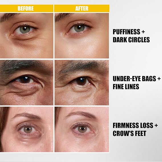 Instant Eye Bag Tightener | Temporary Eye Tightener & Instant Eye Bags Remover | Gentle Nourishing Moisturizing for Hydration & Firmness | Eye Cream for Dark Circles, Puffy Eyes & Makeup Prep