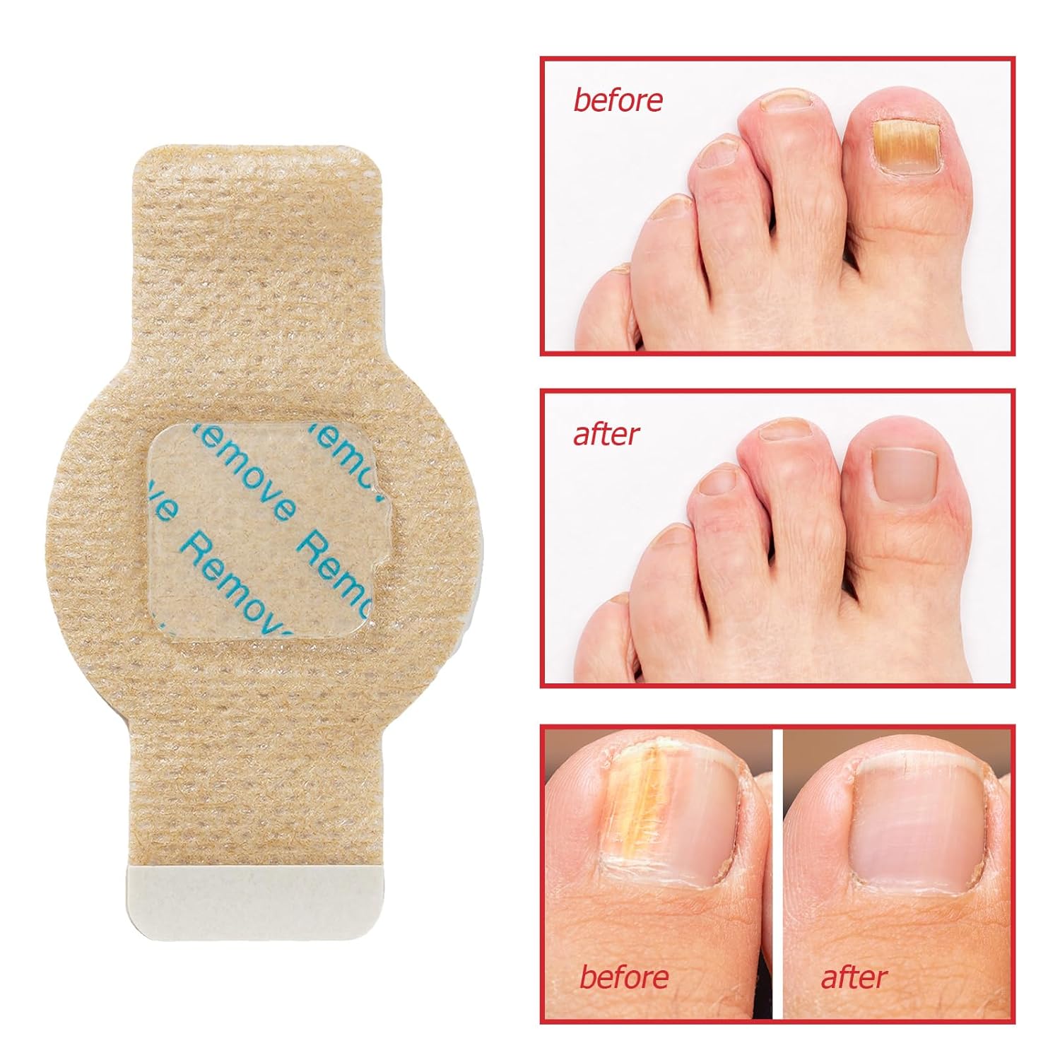 Fungal Nail Patches -Toenail Treatment Extra Strength 21Pcs- Nail Repair for Restores Damaged Nails and Appearance of Discolored - Image 2