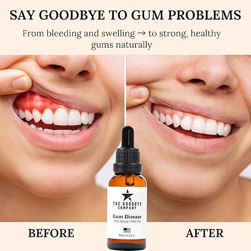 Miniatura 6 de The Goodbye Company Tratamiento para enfermedades de las encías, aceite de neem y clavo 100% puro, remedio natural para la gingivitis, no tóxico,