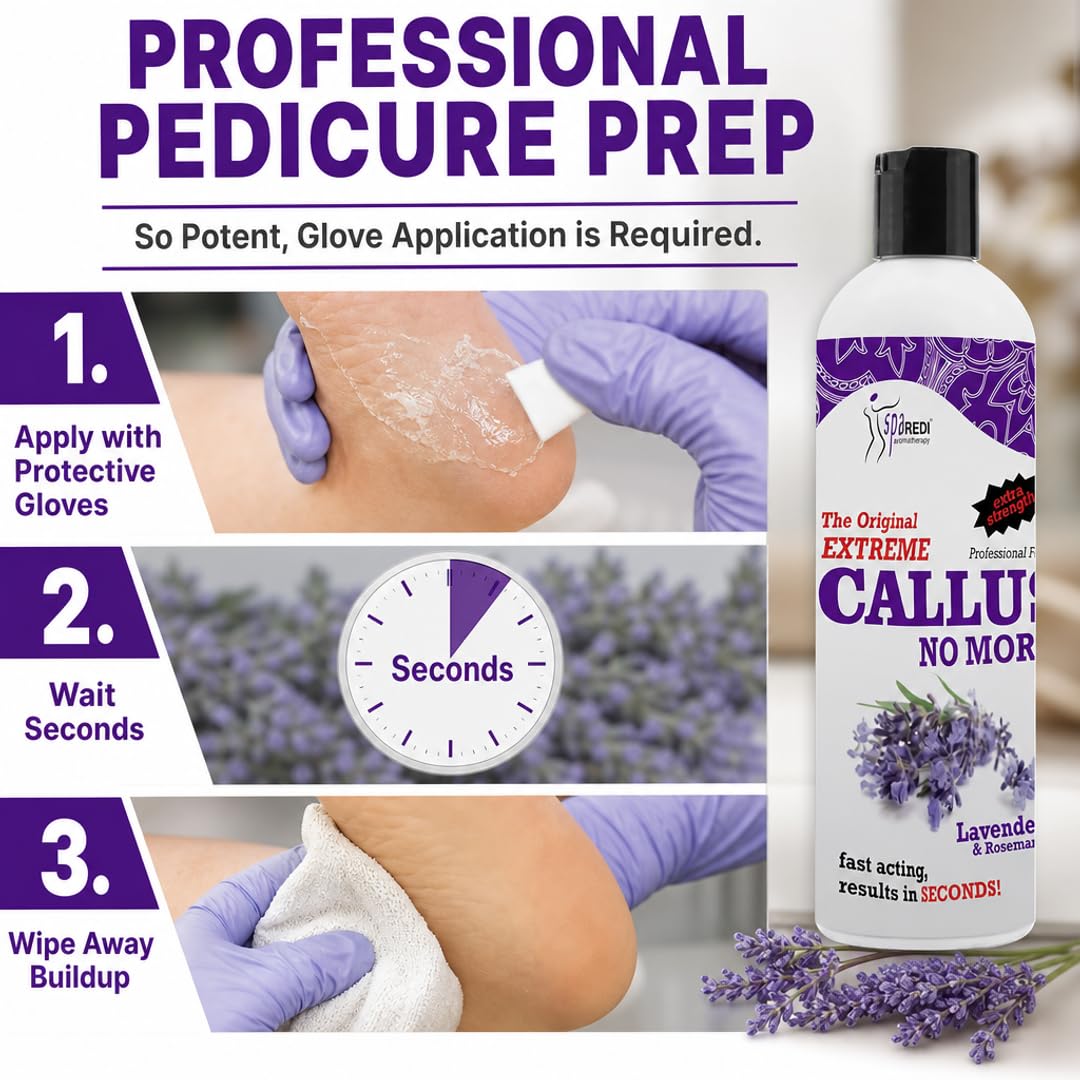 Amazon.com : SPA REDI Callus Remover Gel – 10-30% Potassium