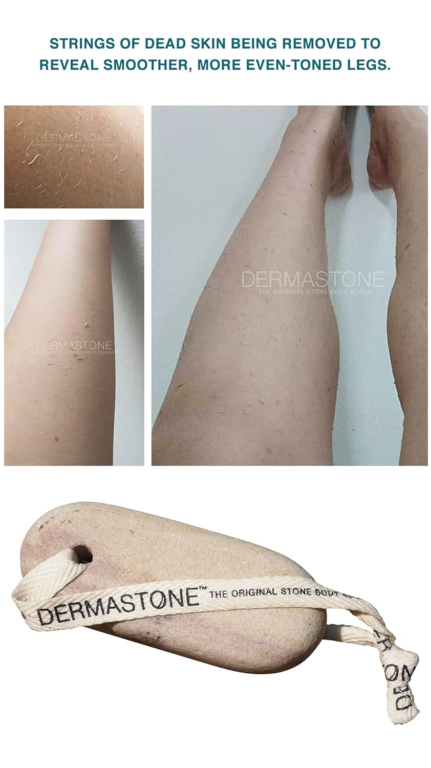 DERMASTONE - Ingrown Hair Treatment For Women, Strawberry Legs Treatment, Natural Dead Skin Remover, & Foot Scrub Exfoliator For Dry Skin : Beauty & Personal Care