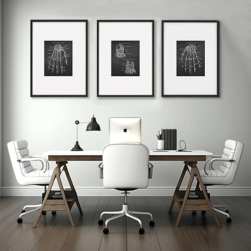 Miniatura 6 de Gnosis Picture Archive Anatomía de huesos de mano médica, juego de 3 impresiones artísticas sin marco, decoración ortopédica de oficina