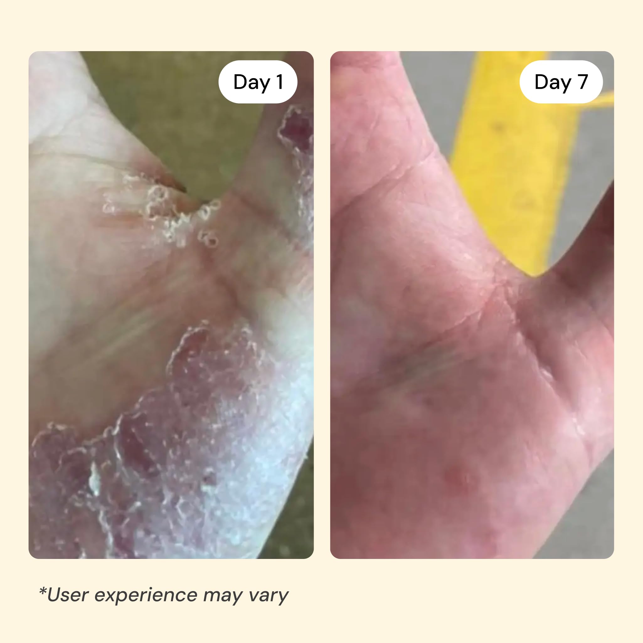 MyMagicHealer Universal Flare Care Sensitive Skin Solution with Propolis & Egg Yolk