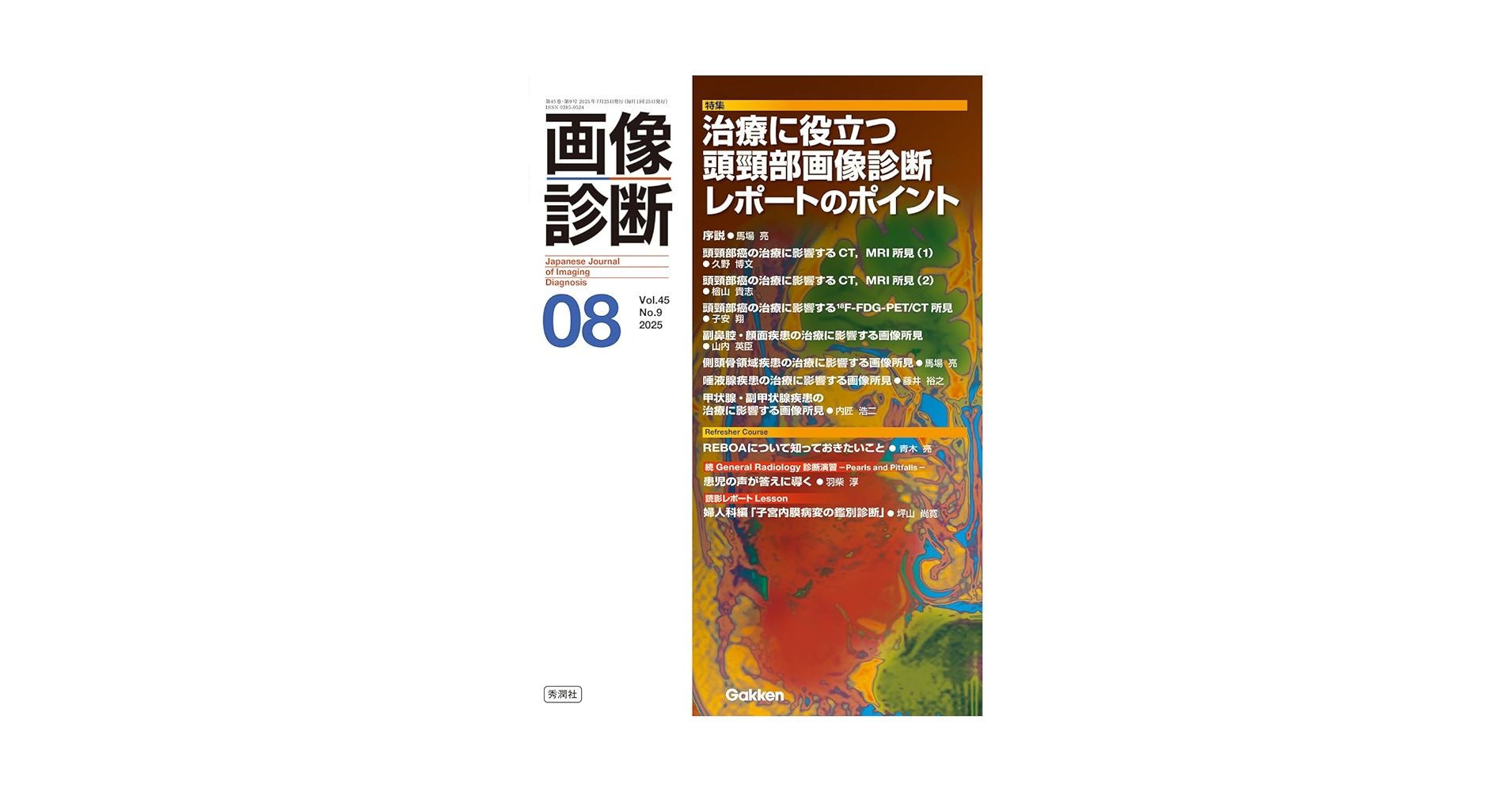 画像診断2025年8月号 Vol.45 No.9: 治療に役立つ頭頸部画像診断