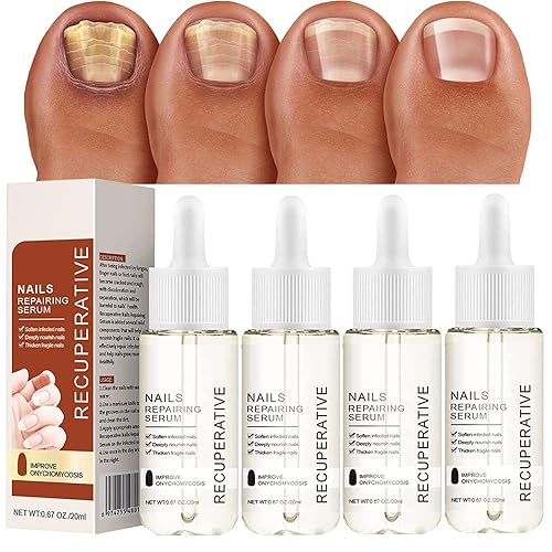 Suero de crecimiento y fortalecimiento de uñas, fortalecedor de uñas, esencia de reparación de suero de uñas, crecimiento de uñas (4 unidades)