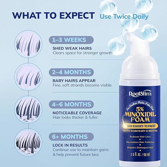 RootStim 5% Minoxidil Foam for men and women, Extra Strength Hair Regrowth Treatment for Thinning Hair and Hair Loss, Hair Follicle Health Thicker, Fuller Hair Growth Solution 6 FL.OZ