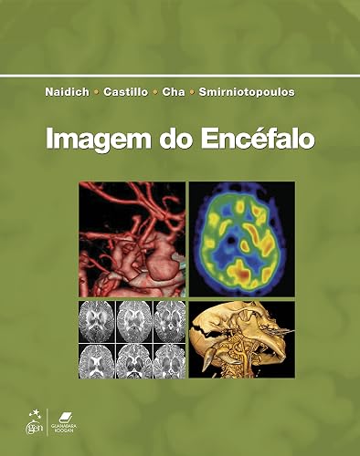 Imagem do Encéfalo