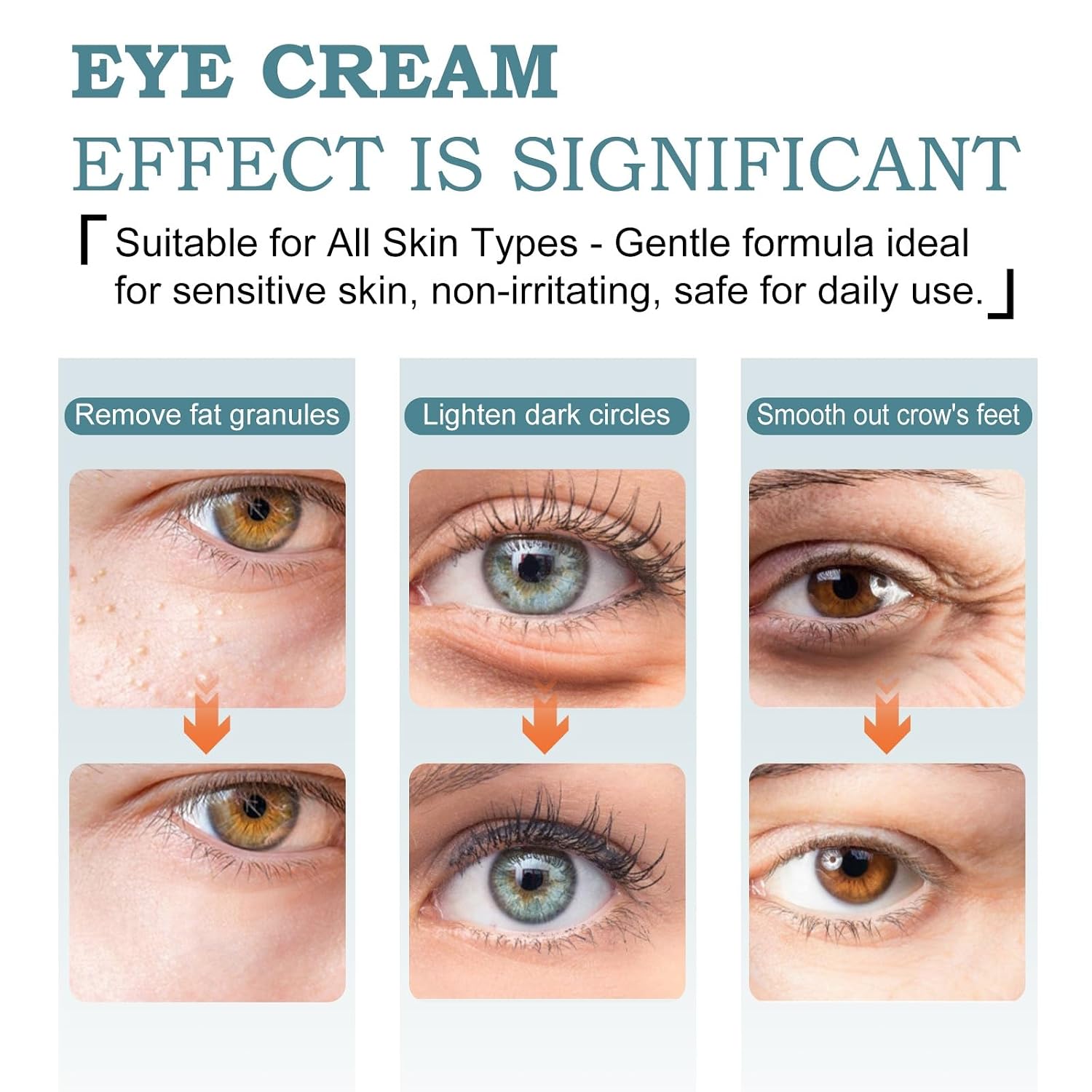 Temporary Tightener Eye Cream-Instantly Reduces Under- Bags, Dark Circles & Wrinkles, Anti-Aging with Retinol & Hyaluronic Acid, Under Eye Creams Suit Women Men Firm Smooth firming Non-Greasy-ABCNBA