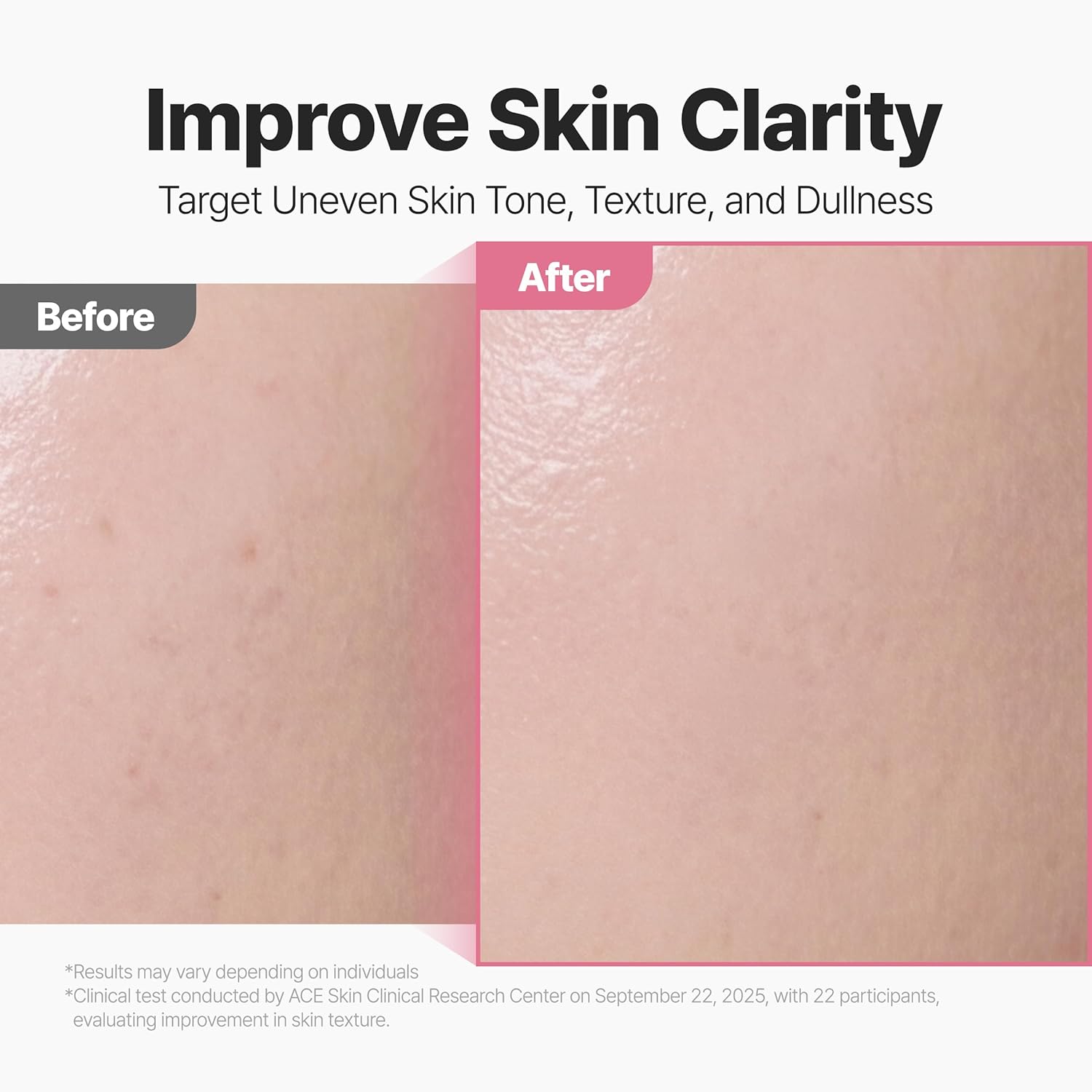 P.CALM Red Rice Glow Peel Shot 8 Serum | LHA-Based Exfoliating Care for Wrinkles, Dark Spot & Dull Skin | Korean Skincare, 80ml / 2.71 fl.oz