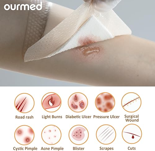 Miniatura 4 de Apósitos de espuma de silicona (2 x 5 pulgadas, 10 paquetes) con borde adhesivo tierno, vendaje absorbente avanzado estéril, cuidado de heridas para