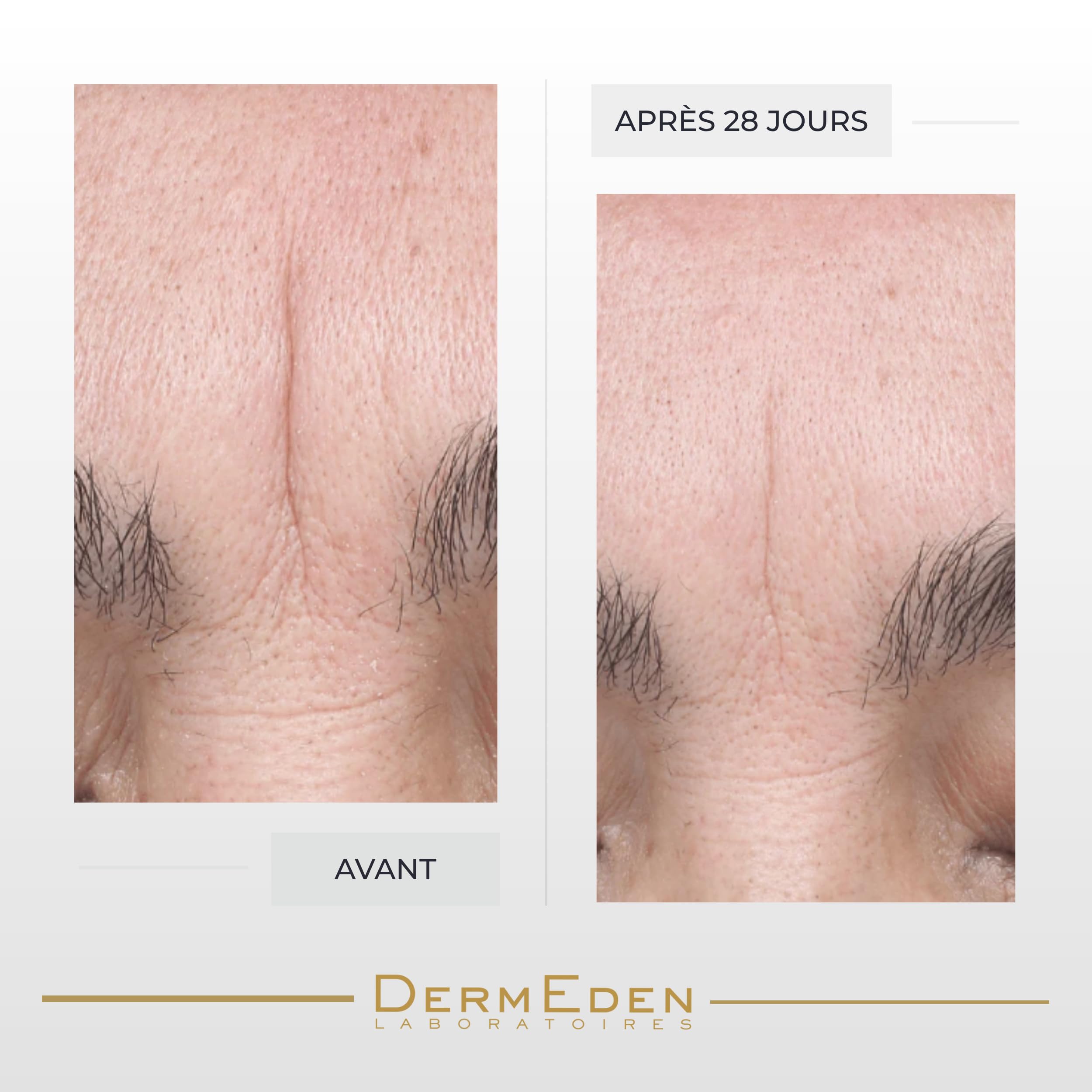 Laboratoires DermEden - Concentré Repulpant et Hydratant 30 ml - Réduit les rides, Améliore l'hydratation et Stimule le collagène - Effet Filler visible dès 30 min - Fabrication Française
