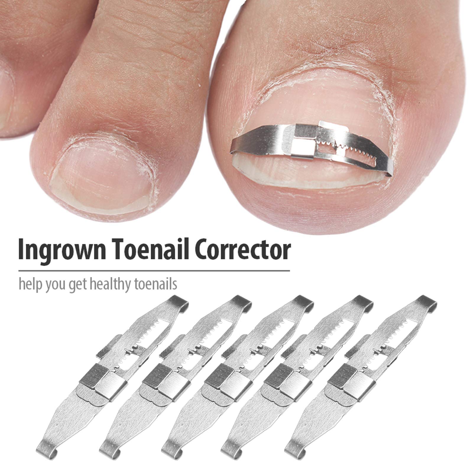 Ingrown Toenail Tools Anself 5pcs Ingrown Toenail Corrector Toenail Correction Treatment Tool Foot Nail Care Tool Orthotic Nail Corrector Pedicure Tool