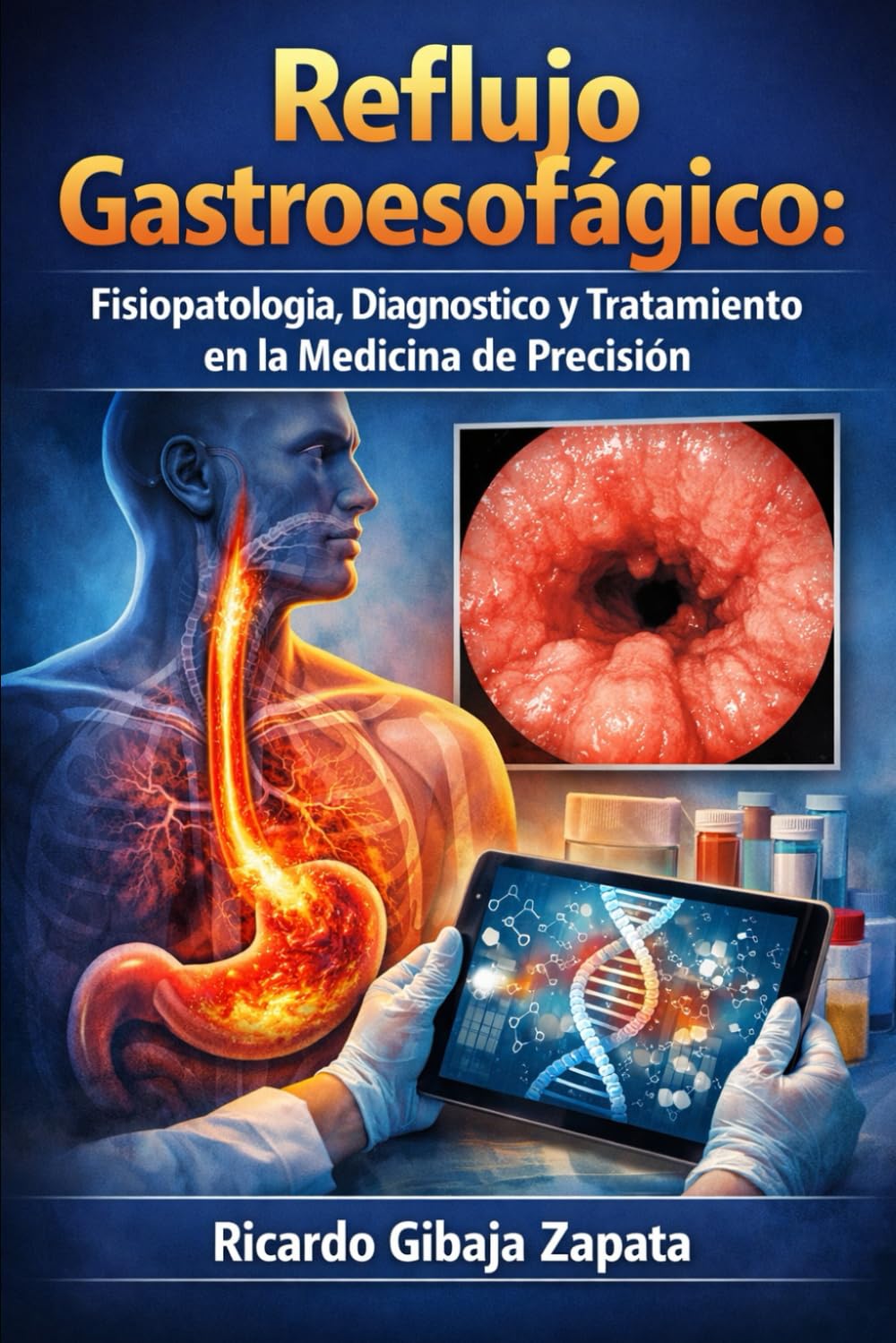Reflujo Gastroesofágico: Fisiopatología, Diagnóstico y Tratamiento en la Medicina de Precisión