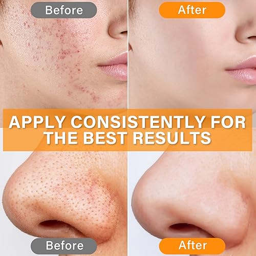 Miniatura 7 de CE Ferulic Serum, Vitamin C E Ferulic Acid Serum, Effective Anti free radical Anti Aging, Reduce Wrinkle & Age Spots