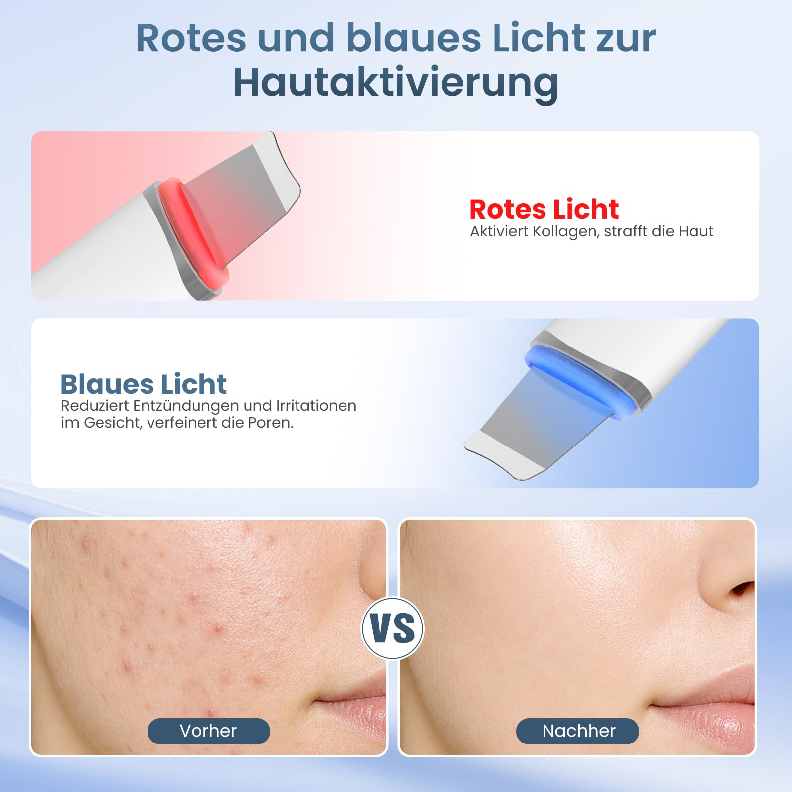 4-in-1 Skin Scrubber Ultraschall, IPX7 wasserdicht Porenreiniger