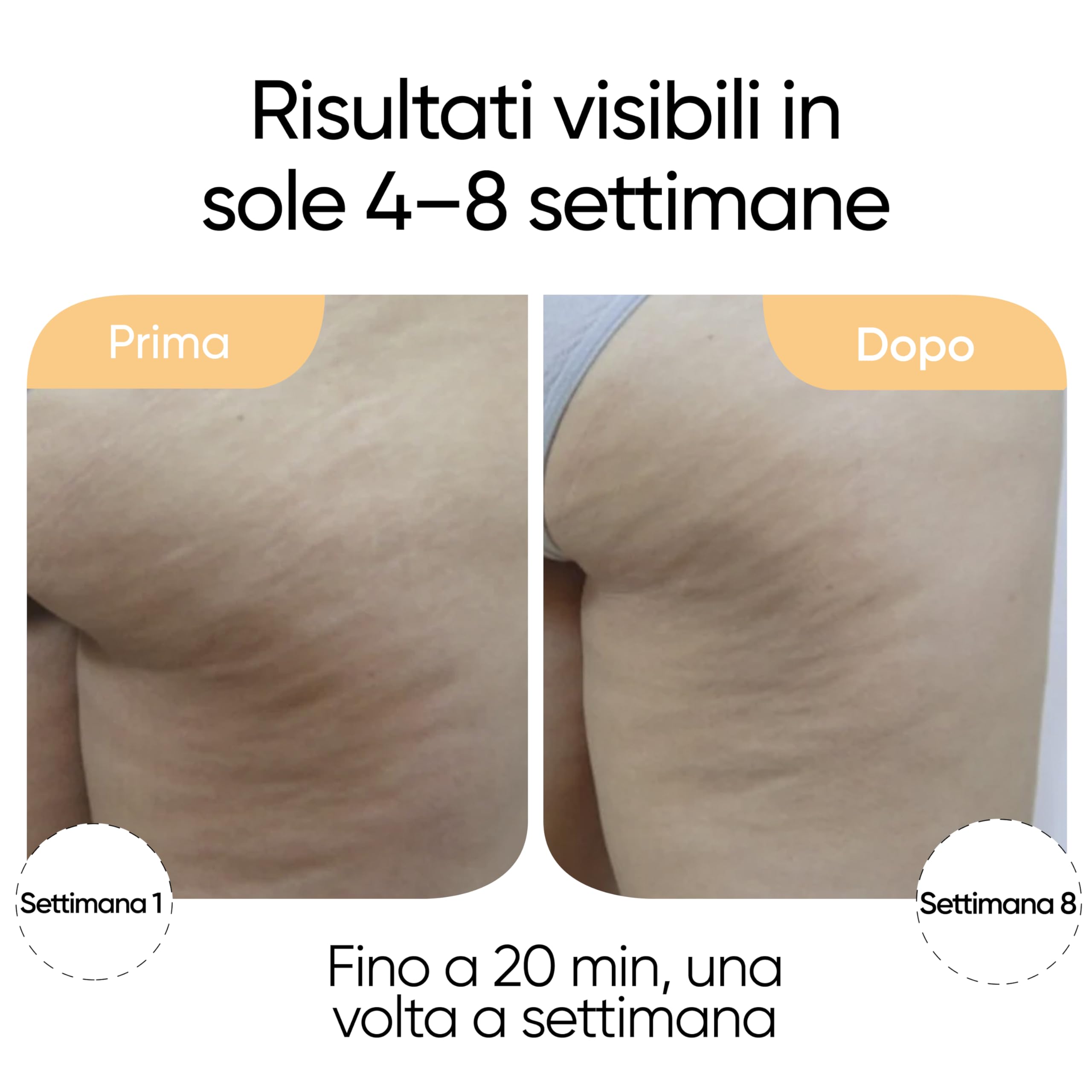 Sensica Sensifirm Dispositivo Radiofrequenza Corpo – Contro Cellulite, Rassodamento Cutaneo e Rimodellamento per Cosce e Glutei, Leviga e Tonifica, Macchina RF Professionale Uso Domestico