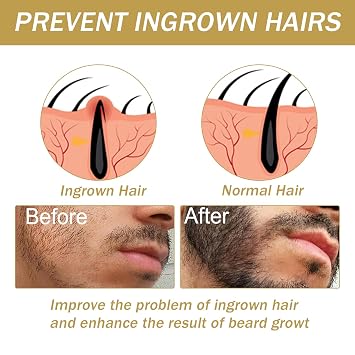 Beard Growth Kit Beard Growth Set with Beard Roller Beard Growth Serum Oil/Beard Roller Beard Growth Kit Stimulates Moustache and Hair Growth Gifts for Men Father