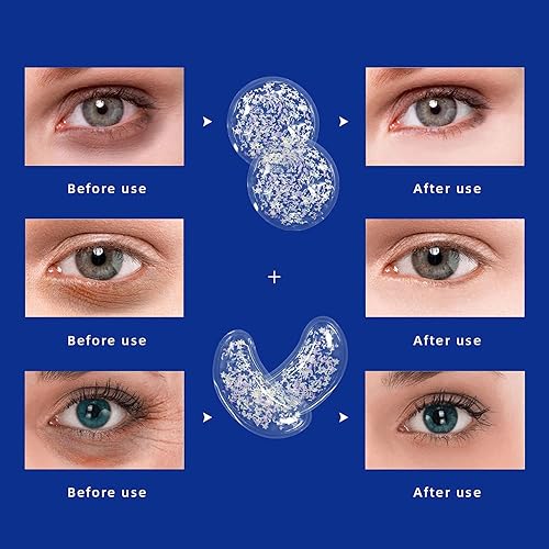 Miniatura 6 de ZNÖCUETÖD Paquete de hielo de gel almohadillas refrescantes reutilizables para los ojos y parches debajo de los ojos, paquete de tratamiento frío