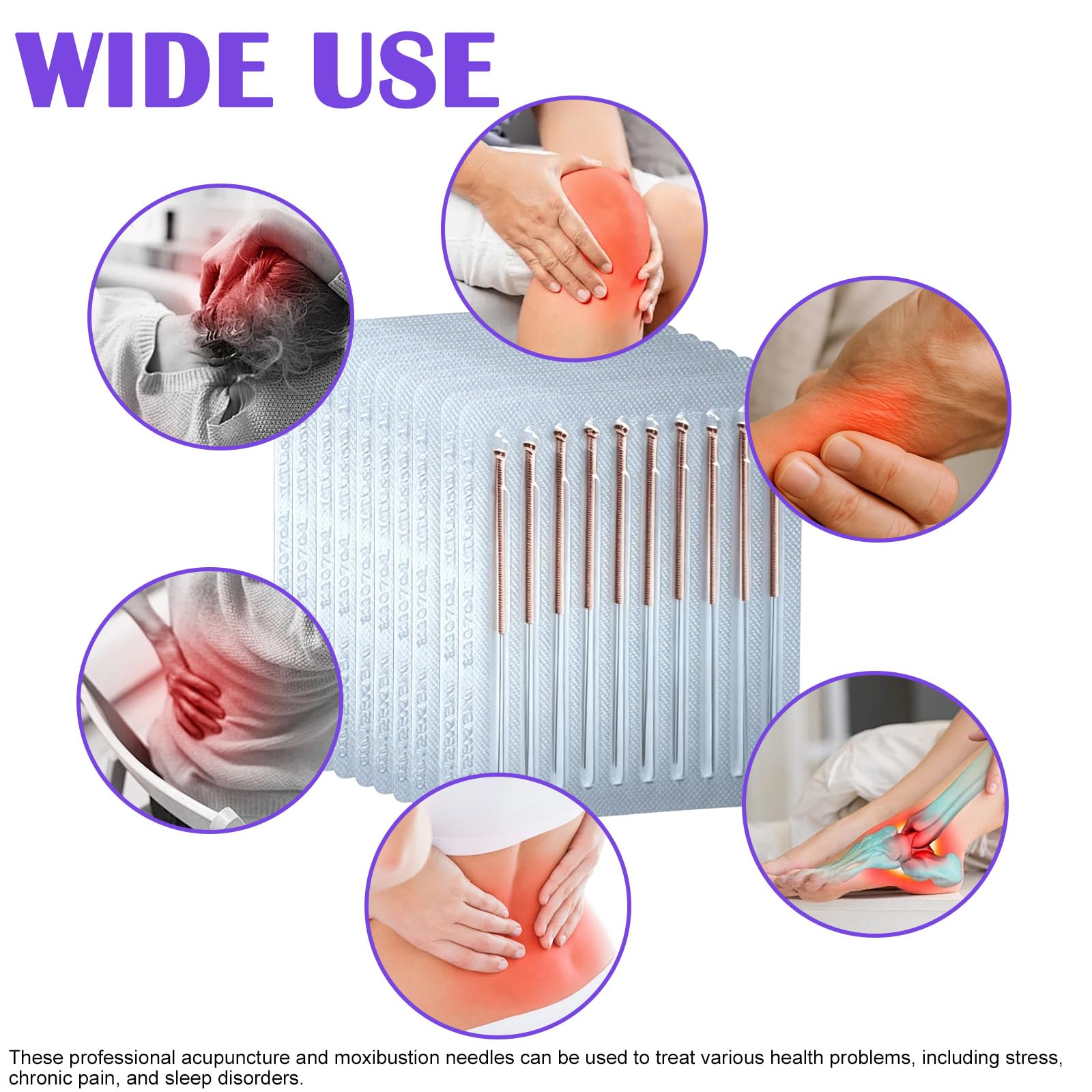 500 Stück Professionelle Akupunkturnadeln, Kupfergriff, Sterile Akupunkturnadeln, 0.30 * 40mm Hochwertige Akupunktur Nadeln, Akupunkturstift Chinesische Massage, Für Therapieanwendungen