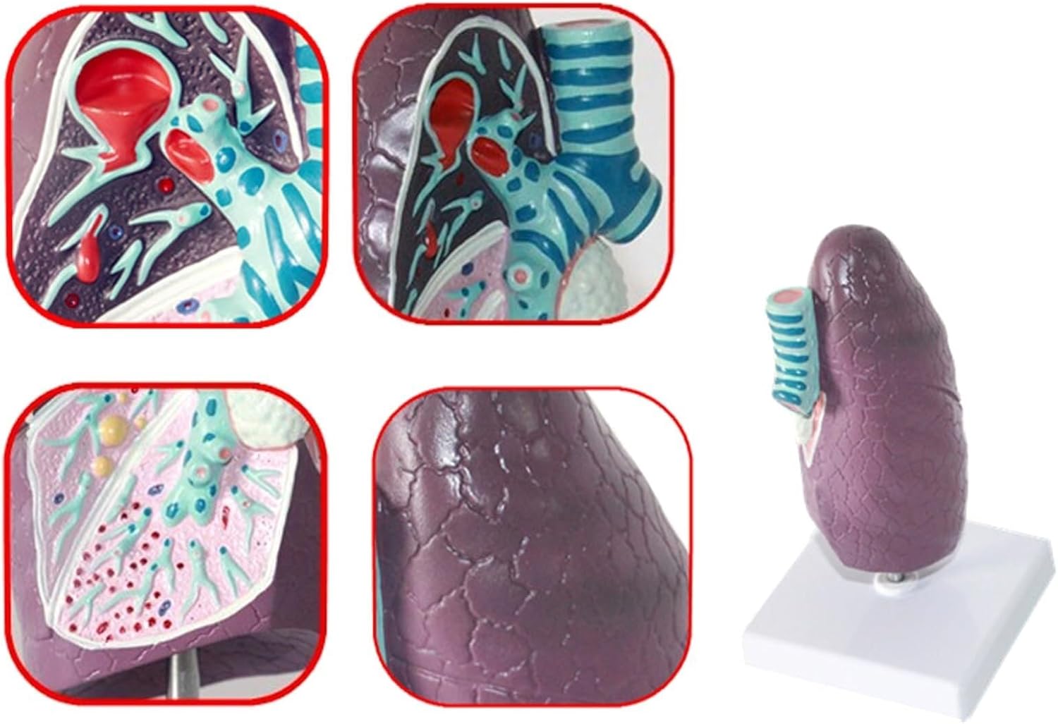 Medical Human pathological Lung Model, Teaching Model, Lung Cancer Model 2:3 Human Lung Anatomy Model, Lung Anatomy Model, for Medical School Study and Research