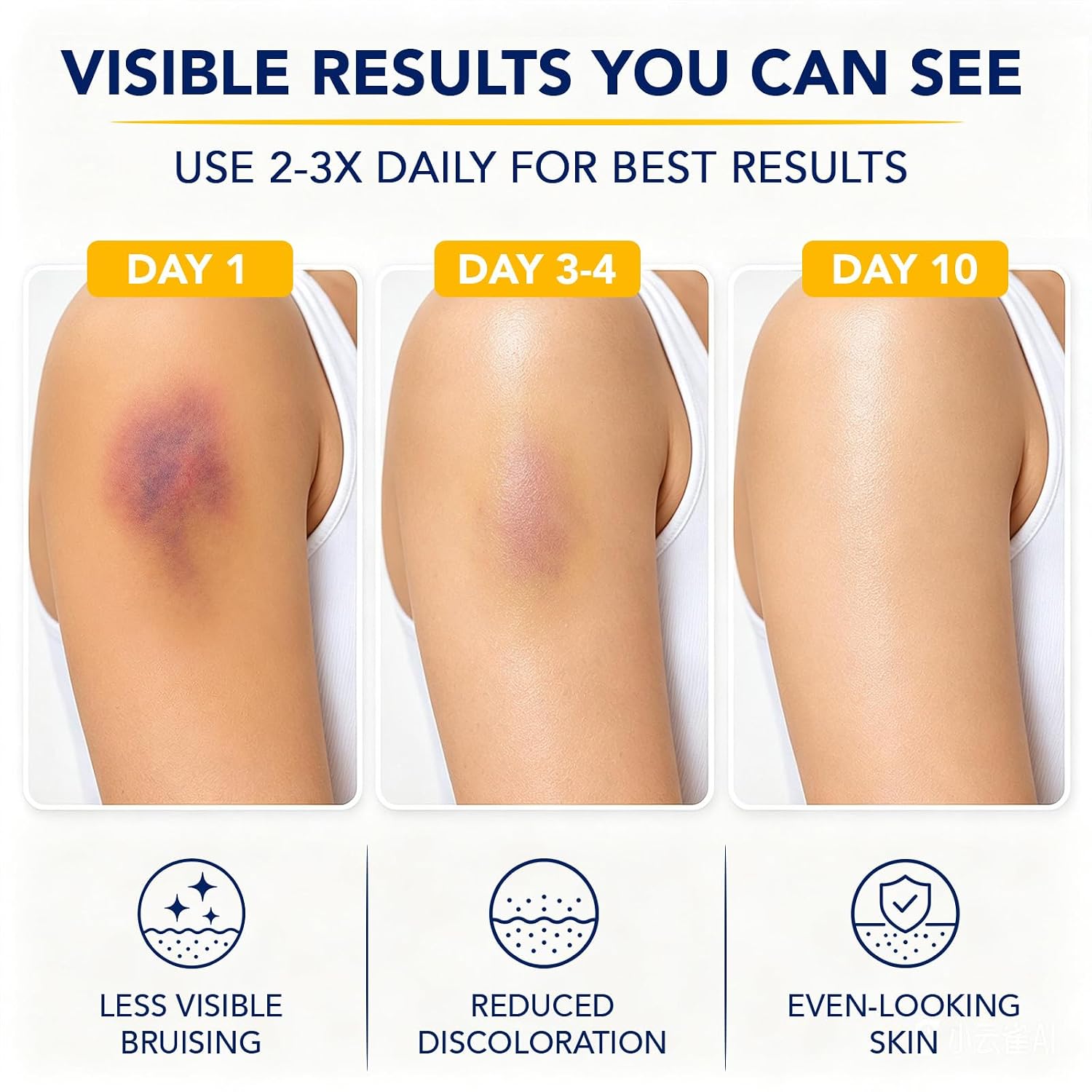 Arnica Cream Extra Strength 4-In-1 with Vitamin K, E, C for Bruising, Swelling, Thin & Sensitive Skin, Moisturizing, Fast-Acting, Plant-Based|4.2 Oz