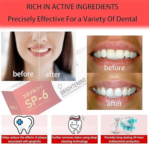 Miniatura 8 de Paquete de 2 pasta dental blanqueadora probiótica SP-6, fórmula mejorada con 6 probióticos para blanquear los dientes y la salud de las encías