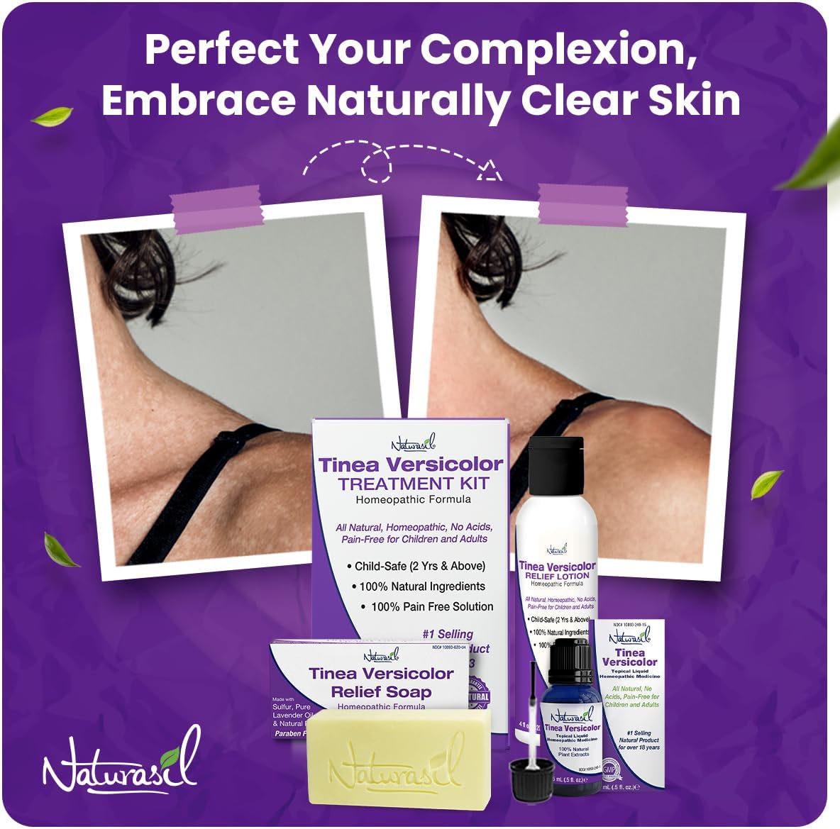 Naturasil FastActing Treatment for Tinea Versicolor, Candida, Jock Itch, Athlete’s Foot