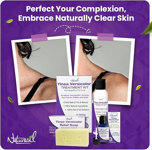 Miniatura 4 de Naturasil Tinea Versicolor Kit de tratamiento - Alivio antifúngico de máxima fuerza para la decoloración de la piel, manchas solares y picazón |