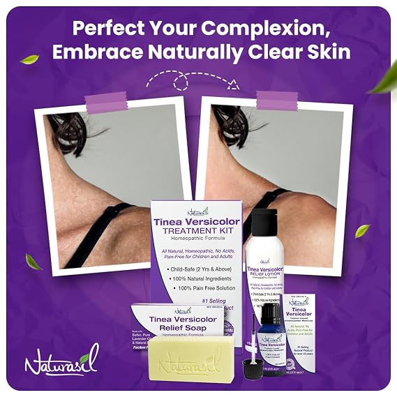 Naturasil Tinea Versicolor Treatment 2-Step Kit with Lotion & Sulfur Soap