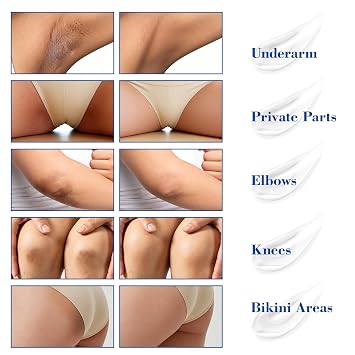 Skin Bleaching Cream, Skin Lightening Cream for Intimate Area, Inner Thighs, Bikini Line, Hydrating Whitening for Body Sensitive Areas, Underarms, Elbows, Knees, 1.7 Fl OZ