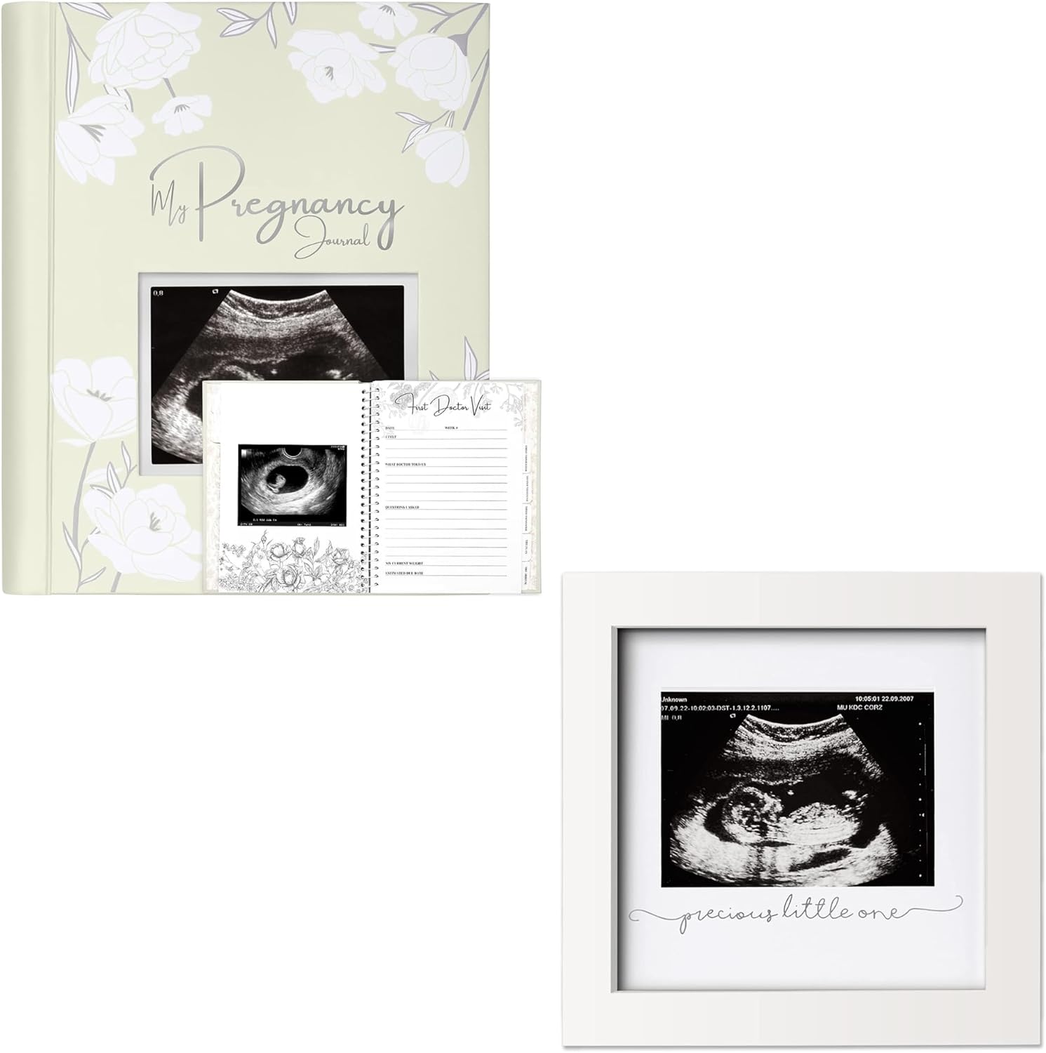 KeaBabies Pregnancy Journal, Modern Ultrasound Picture Frame for Baby Announcements, 80 Pages Hardcover Book for Mom-to-Be, Includes Checklists and Memories